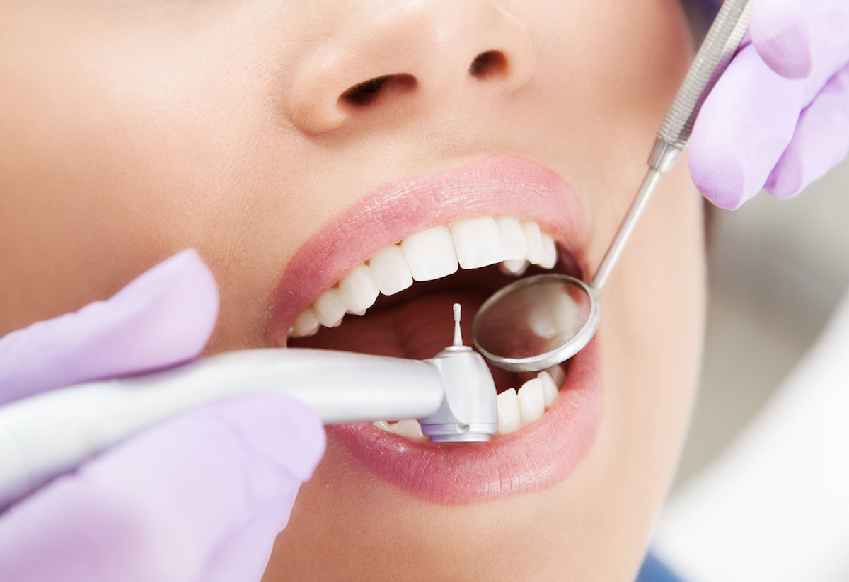 bolesti zuba, plombiranje zuba, endodoncija, lečenje zuba